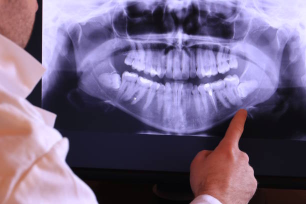 Best Emergency Root Canal Therapy in Oshkosh, WI